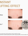 99% Collagen Forehead Patches