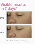 Barrier Repair Mask with Ceramides