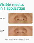 Deep Pore Cleansing Nose Strips with Charcoal