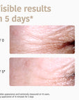 Eye Contour Patches Global Anti-age with Niacinamide