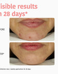 Perfect Skin Peeling Face Sheet Mask with Glycolic Acid