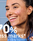 Prevent & Correct Anti-Blemish Serum