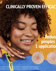 PRIDE Pimple Patches with Salicylic Acid