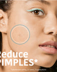 SOS Pimple Patches with Salicylic Acid