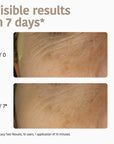 Wrinkle Filler Face Sheet Mask with Triple Hyaluronic Acid
