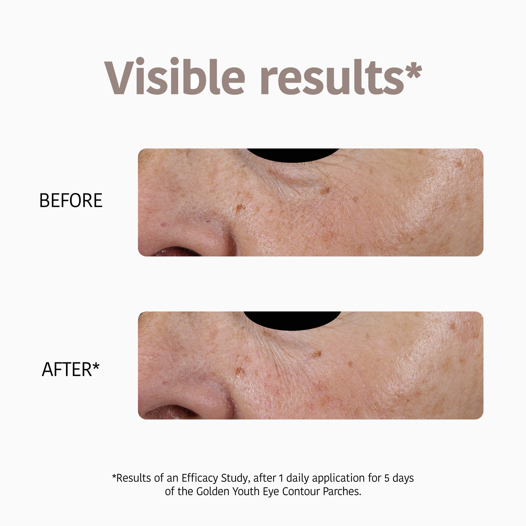 Anti-Aging Eye Patches with Gold &amp; Peptides