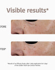 Anti-Aging Eye Patches with Gold & Peptides