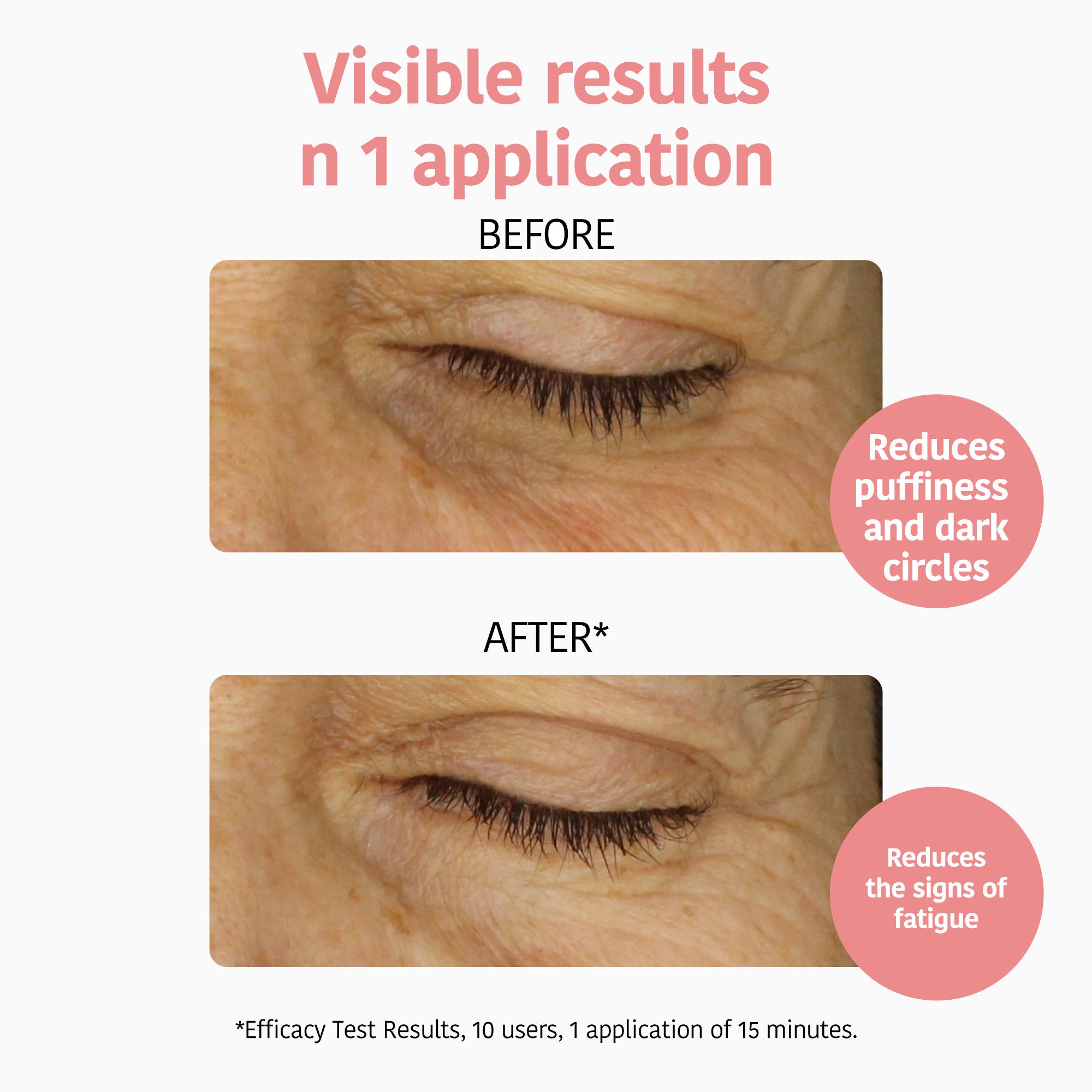 Anti-fatigue and Illuminating Eye Contour Patches with Vitamin C