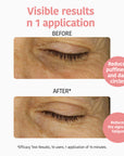 Anti-fatigue and Illuminating Eye Contour Patches with Vitamin C
