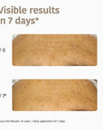 Anti-Wrinkles Face Sheet Mask with Collagen