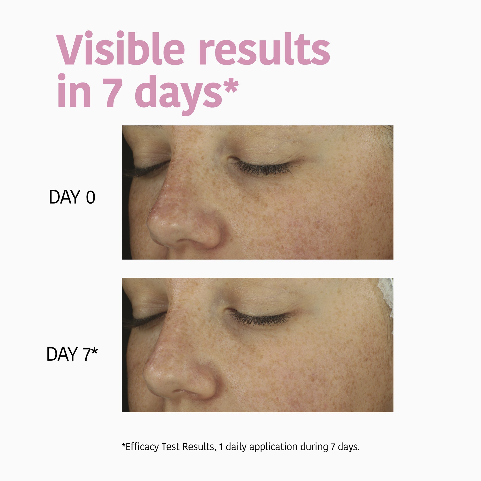 Barrier Repair Mask with Ceramides