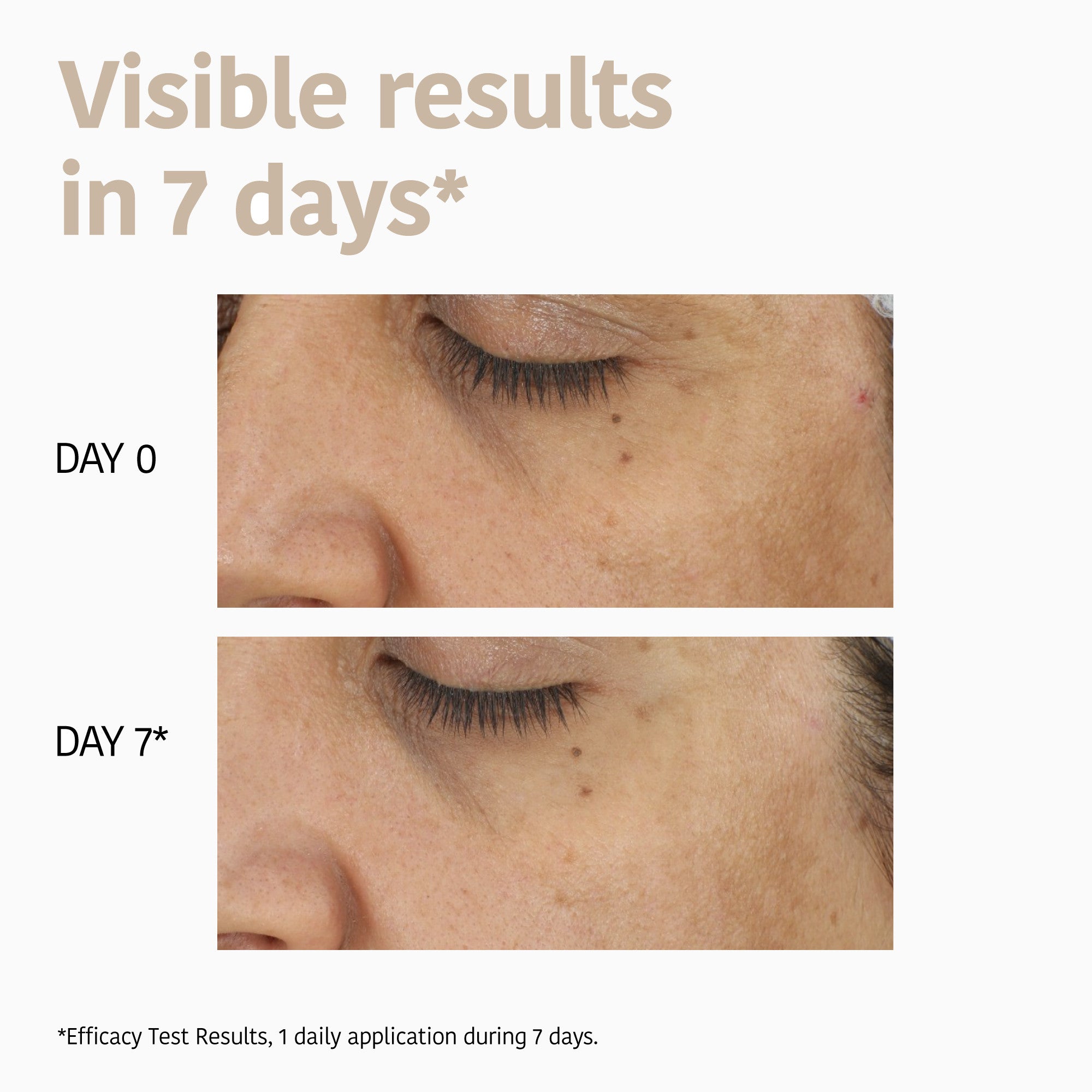 Dark Spots Face Sheet Mask with Tranexamic Acid