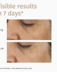 Dark Spots Face Sheet Mask with Tranexamic Acid