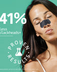 Deep Pore Cleansing Nose Strips with Charcoal