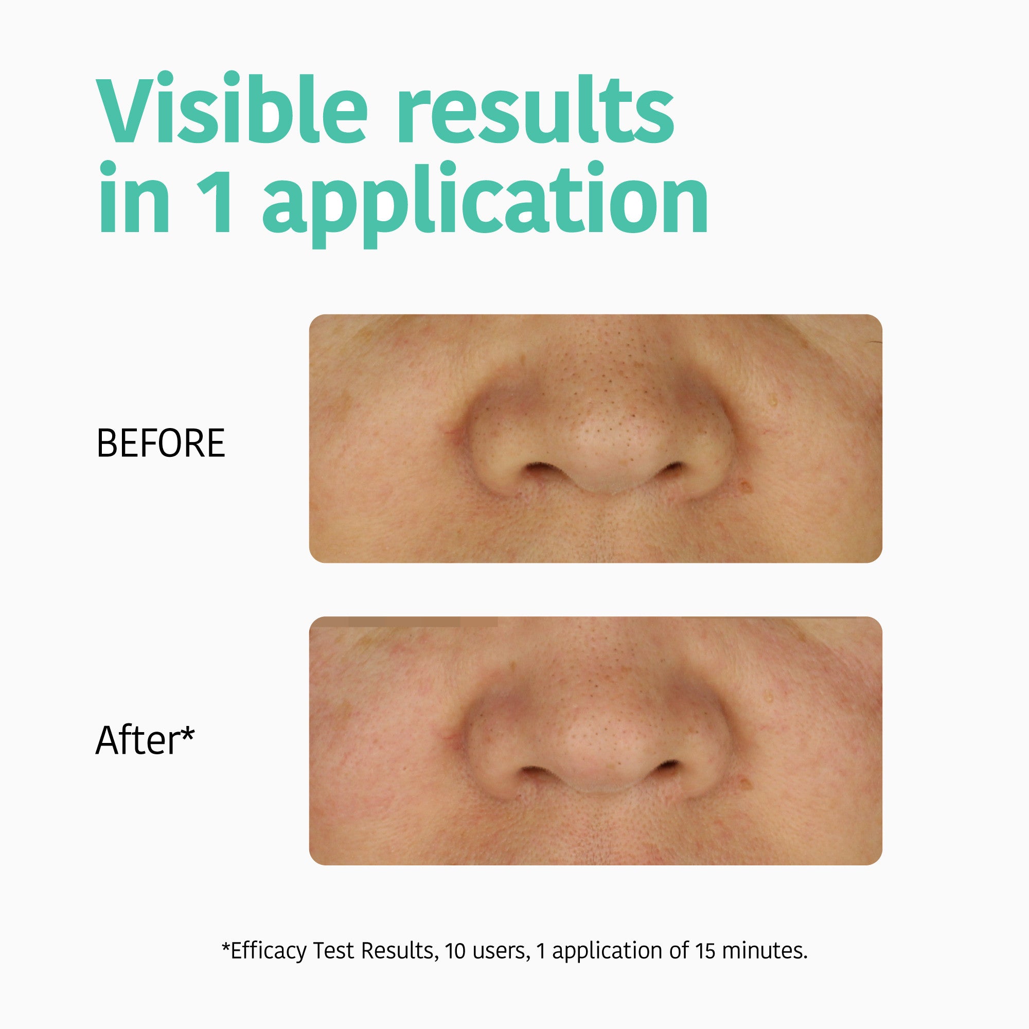Deep Pore Cleansing Nose Strips with Charcoal