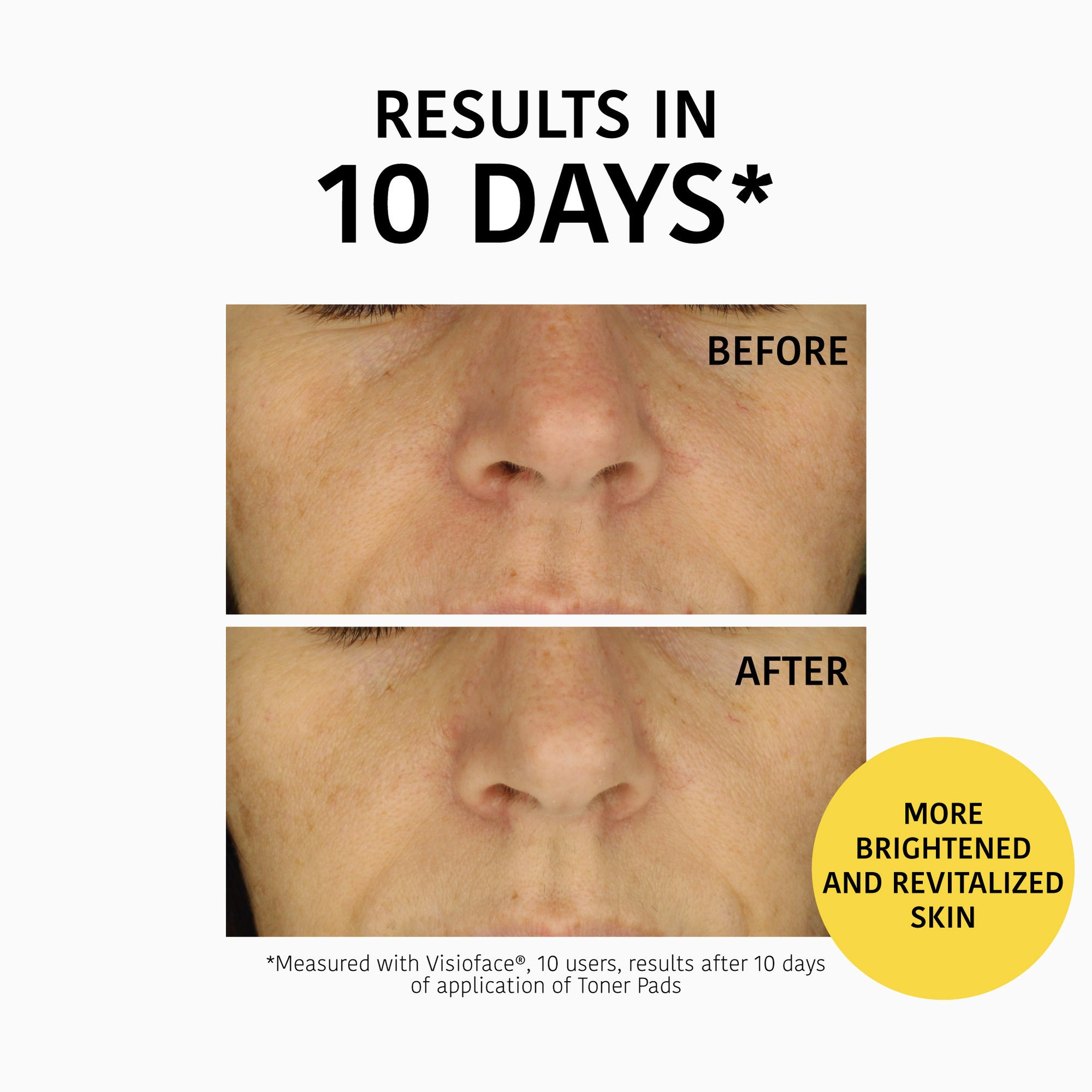 Exfoliating and Brightening Toner Pads with Glycolic Acid