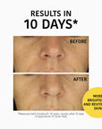 Exfoliating and Brightening Toner Pads with Glycolic Acid