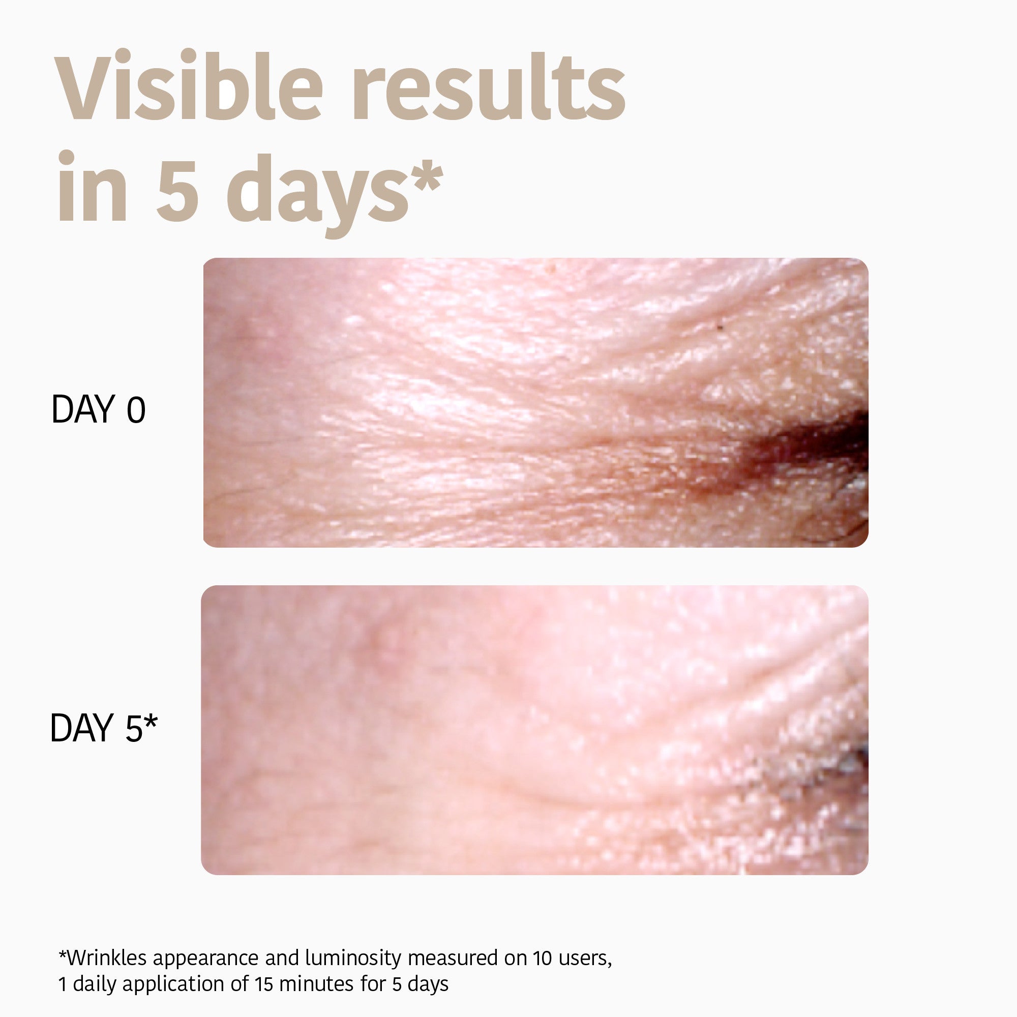 Eye Contour Patches Global Anti-age with Niacinamide