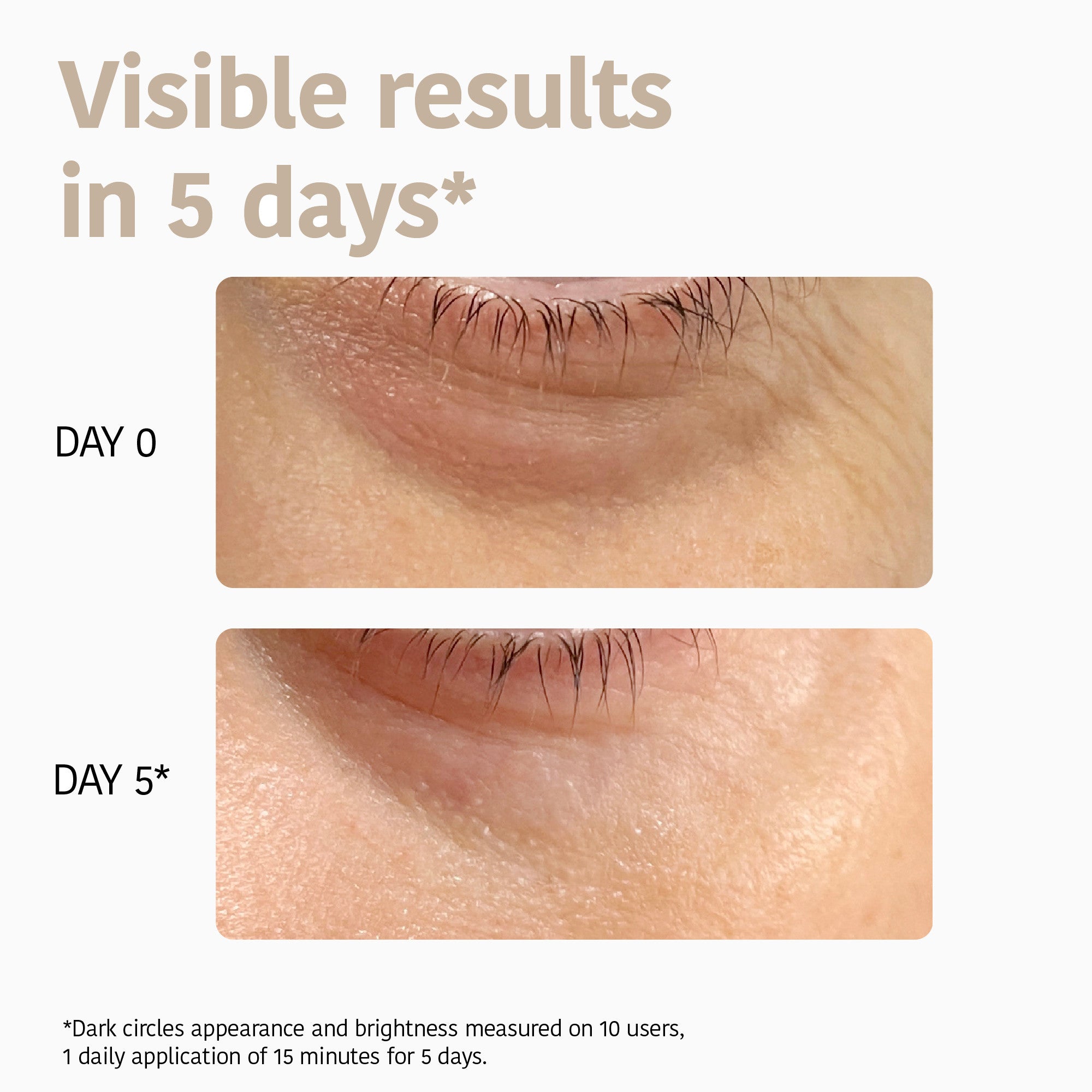 Eye Contour Patches Global Anti-age with Niacinamide