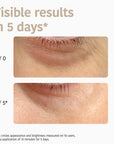 Eye Contour Patches Global Anti-age with Niacinamide