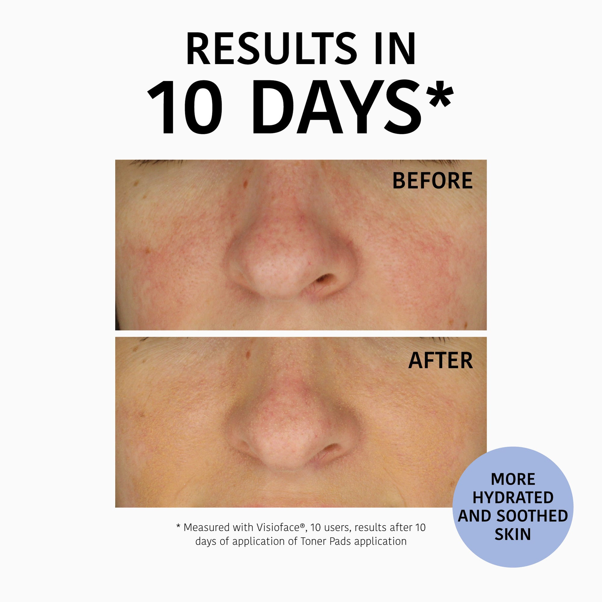 Hydrating and Soothing Toner Pads with Blueberries
