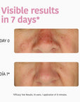 Hydrating Face Sheet Mask with Aloe Vera