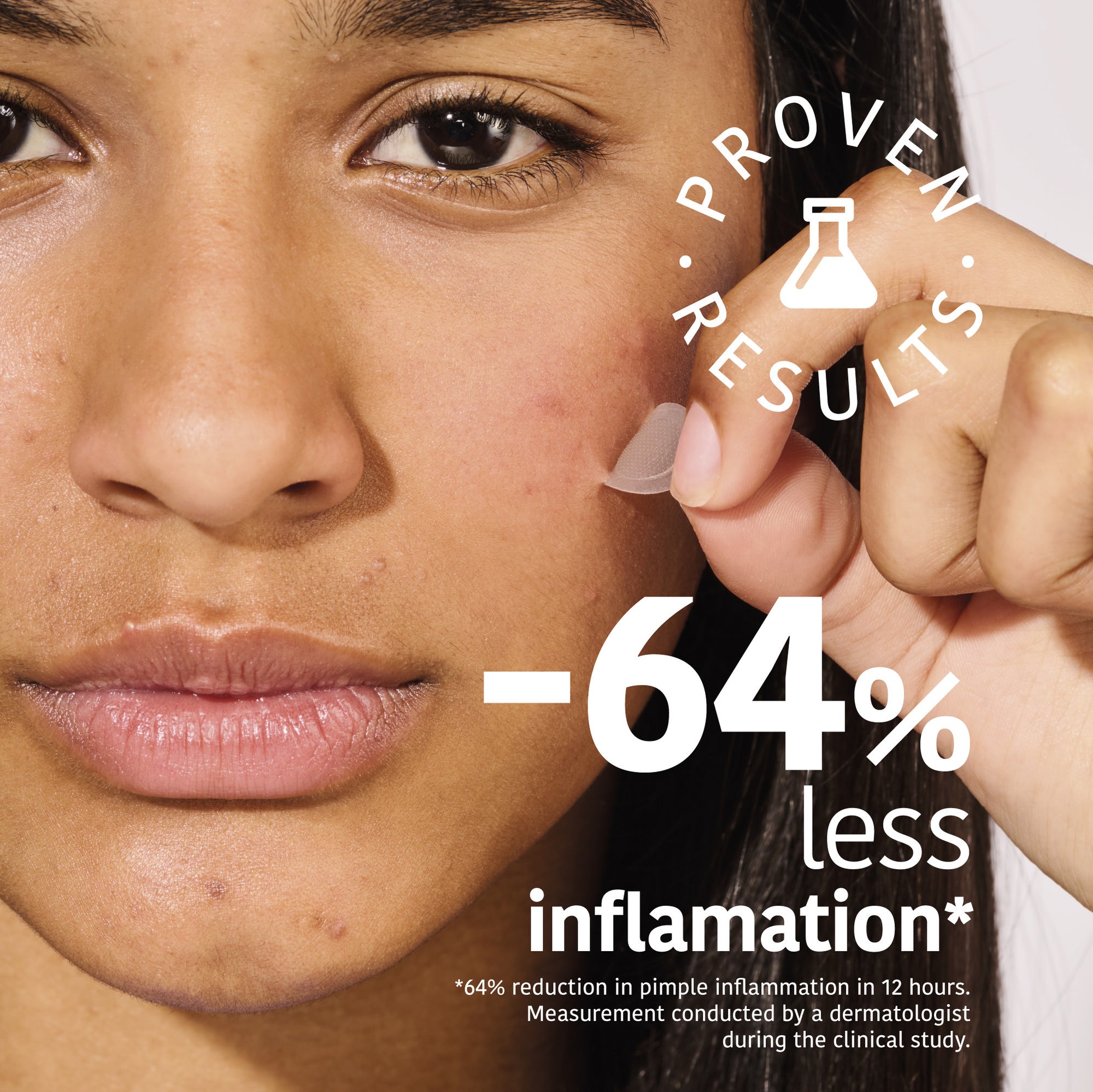 Microdarts Pimple Patches with Salicylic Acid