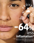 Microdarts Pimple Patches with Salicylic Acid