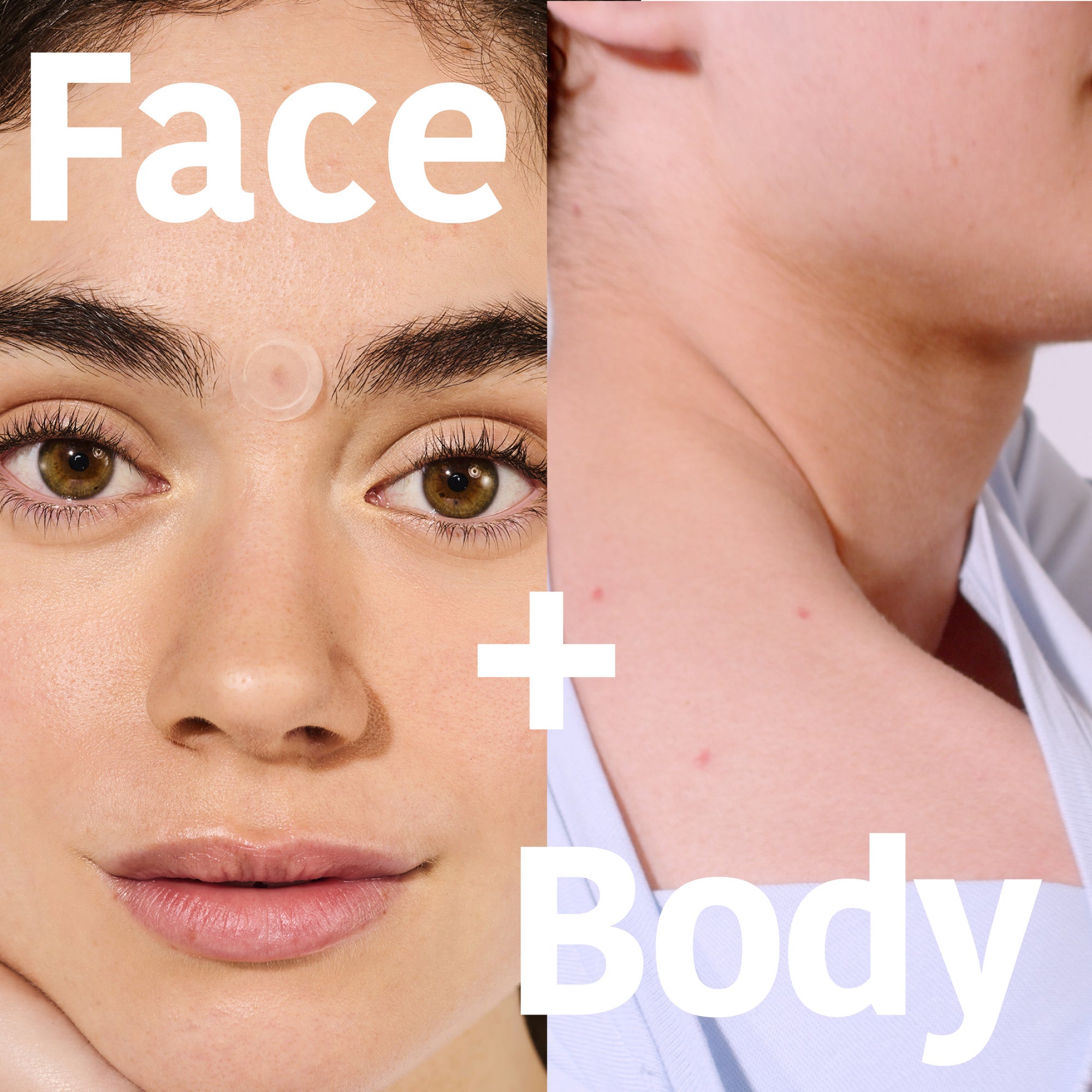 Microdarts Pimple Patches with Salicylic Acid
