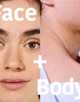 Microdarts Pimple Patches with Salicylic Acid