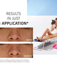 Nourishing Aftersun Face Sheet Mask