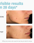 Oil Control Anti-Blemish Cream