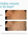 Prevent & Correct Anti-Blemish Serum