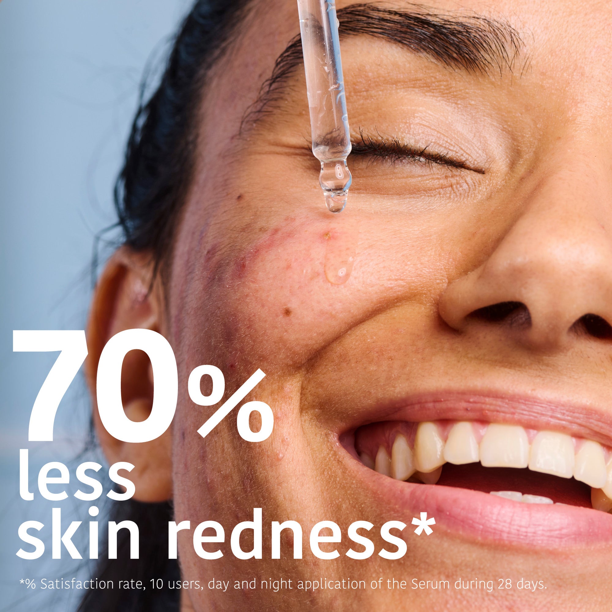 Prevent &amp; Correct Anti-Blemish Serum