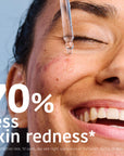 Prevent & Correct Anti-Blemish Serum