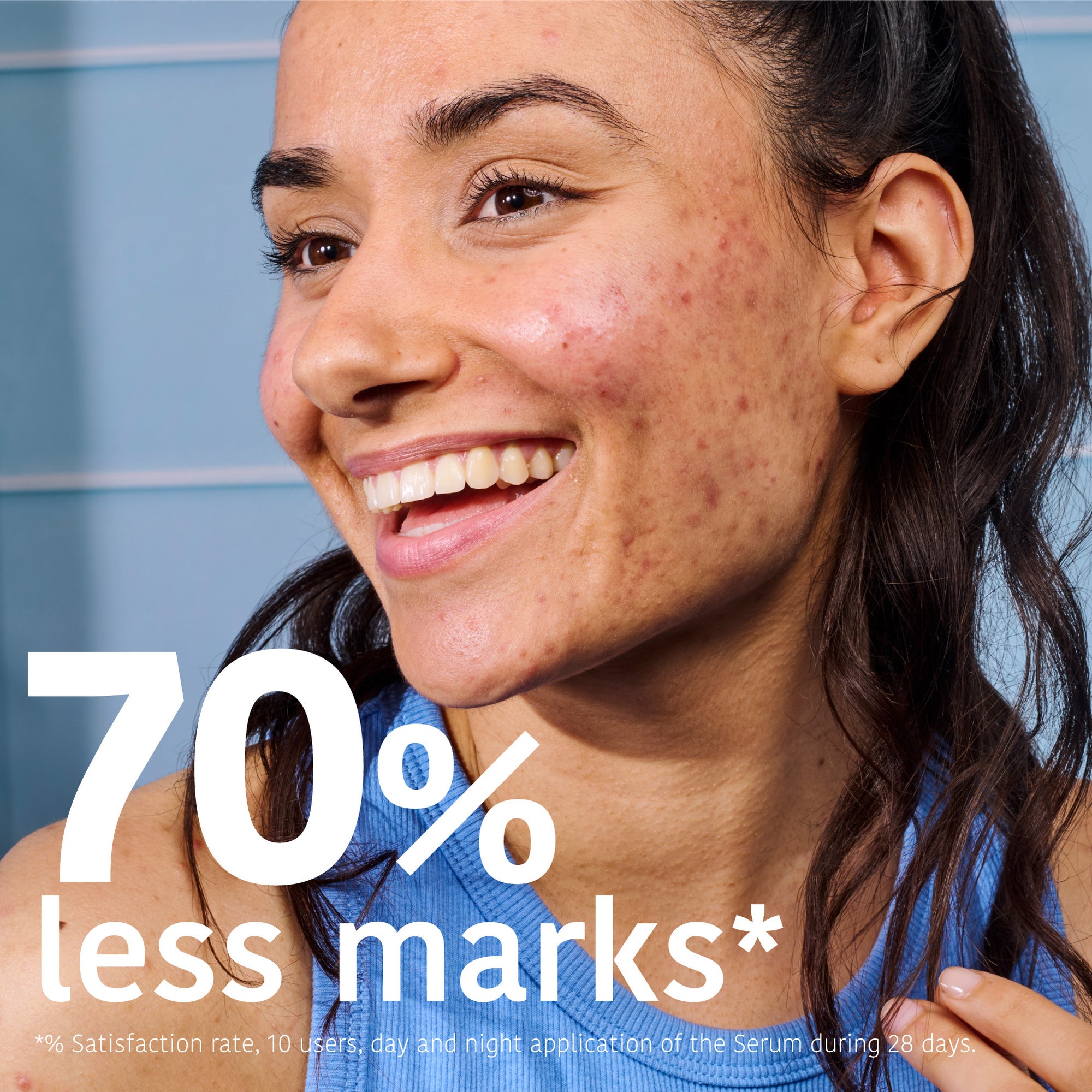 Prevent &amp; Correct Anti-Blemish Serum