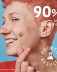 PRIDE Pimple Patches with Salicylic Acid