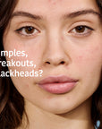 Purifying Anti-Blemish Cleansing Gel