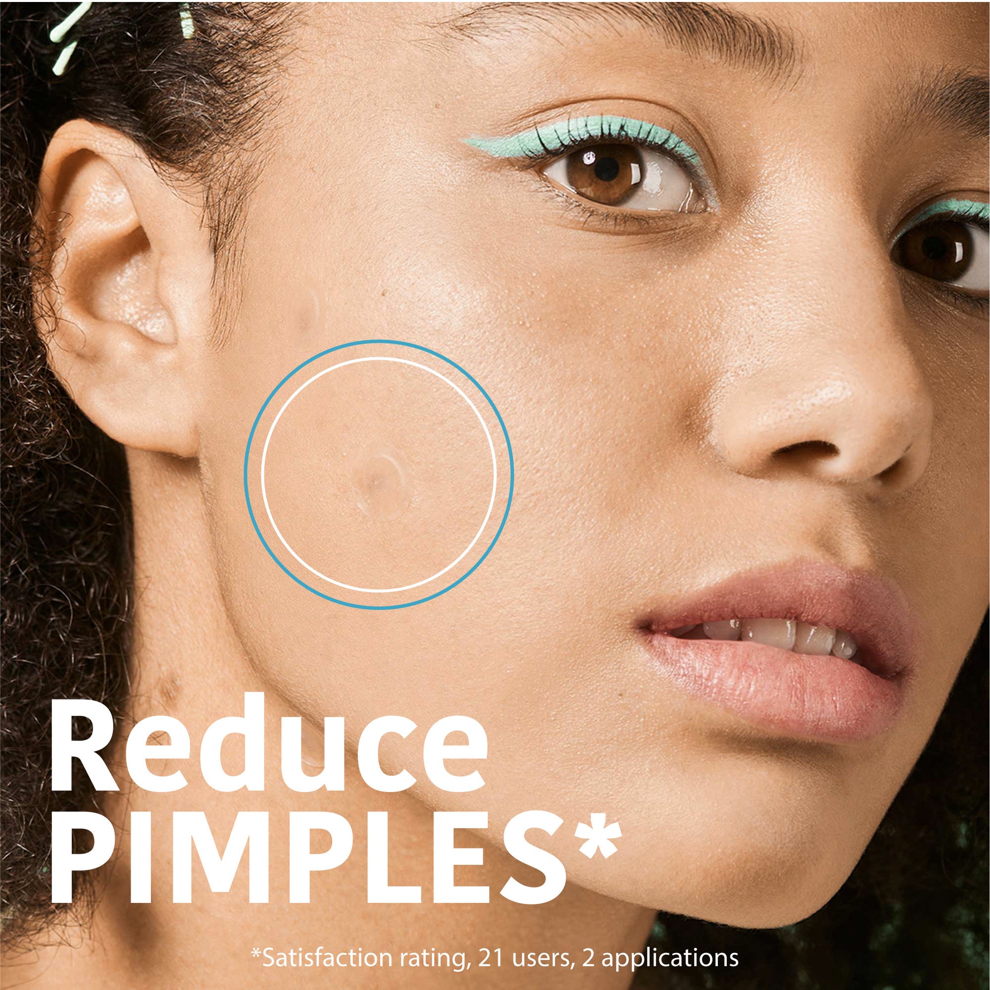SOS Pimple Patches with Salicylic Acid