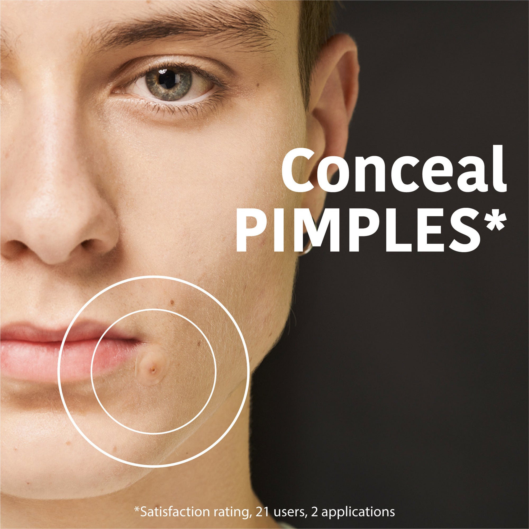 SOS Pimple Patches with Salicylic Acid