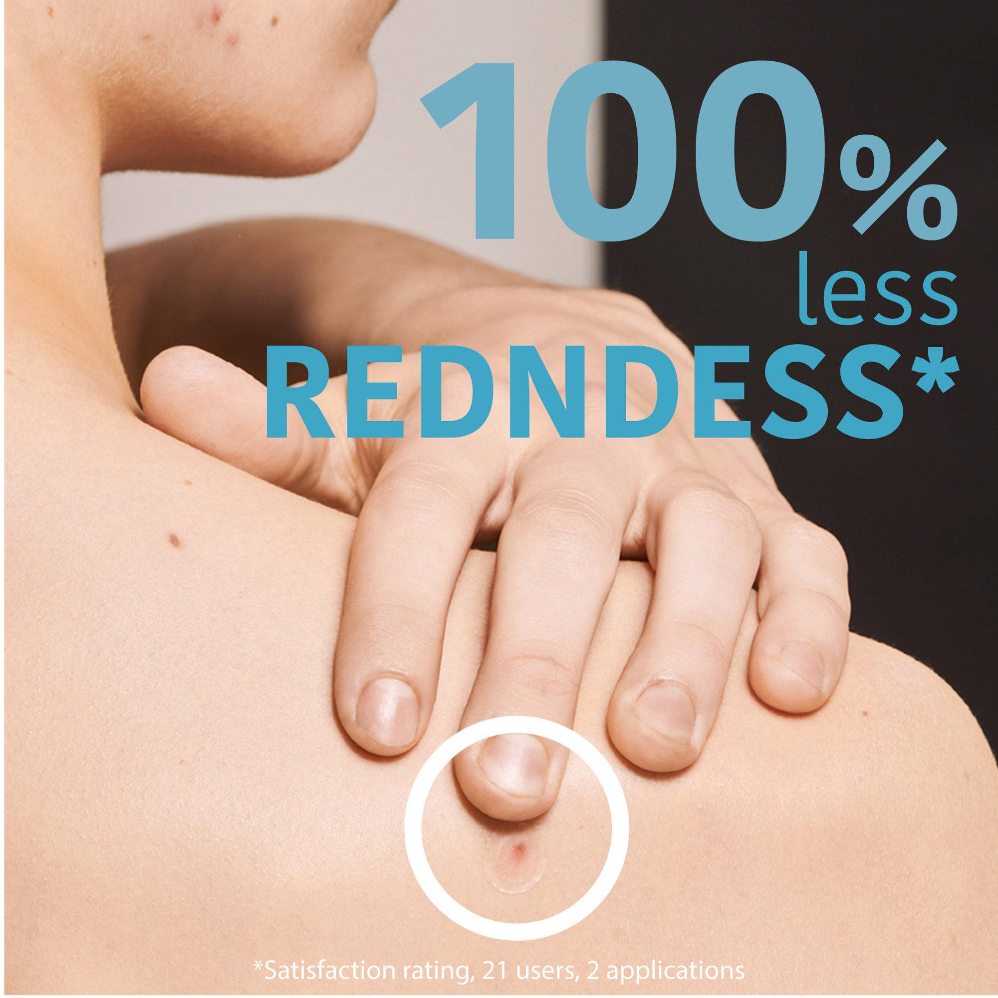 SOS Pimple Patches with Salicylic Acid