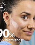XL Pimple Patches with Salicylic Acid