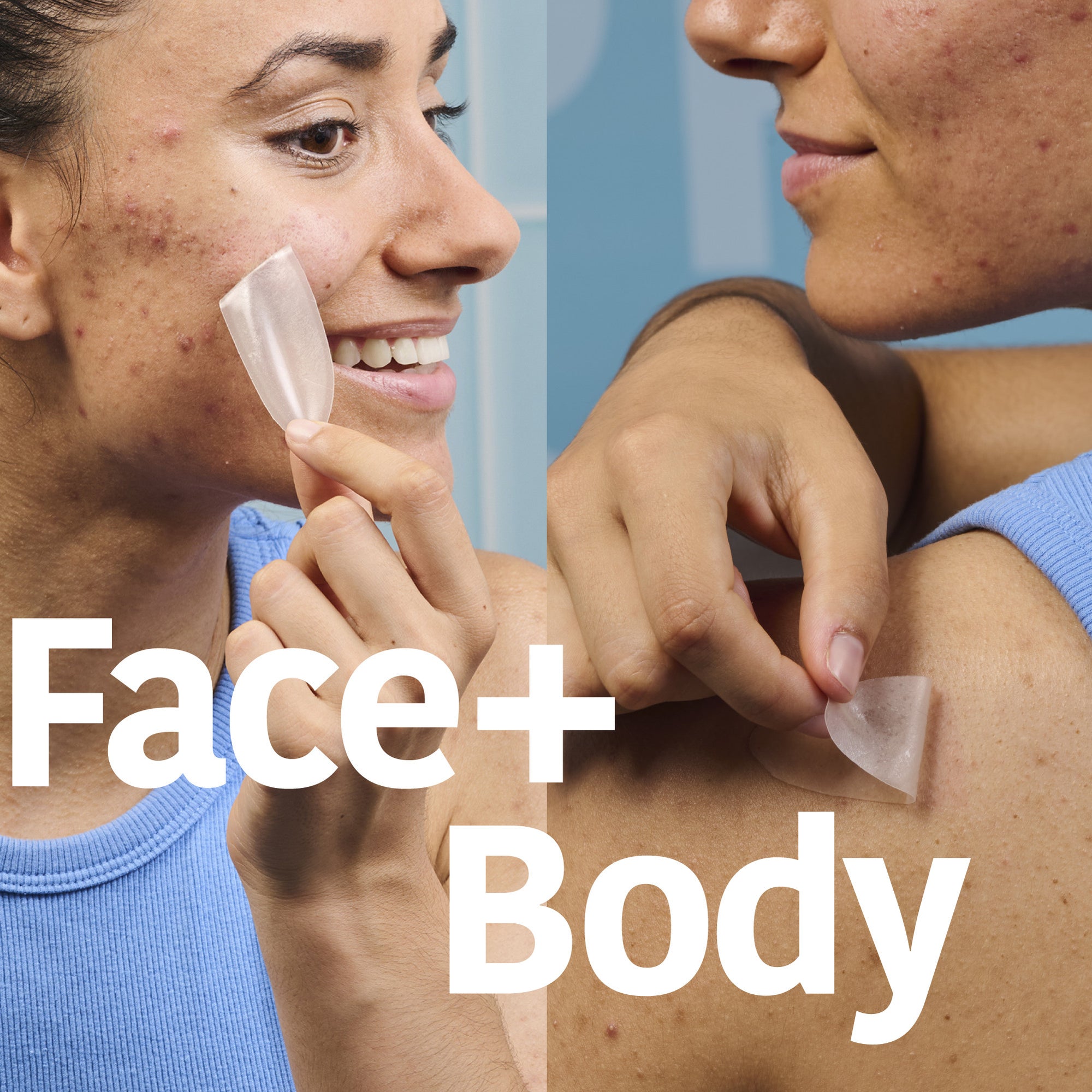 XL Pimple Patches with Salicylic Acid