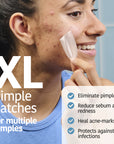 XL Pimple Patches with Salicylic Acid