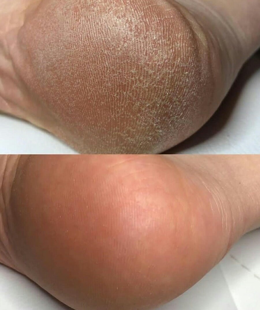 Foot Cream 15% Urea - BYŪTI