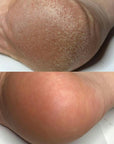 Foot Cream 15% Urea - BYŪTI