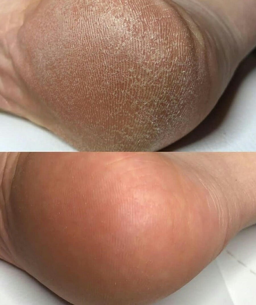 Foot Cream 15% Urea - BYŪTI